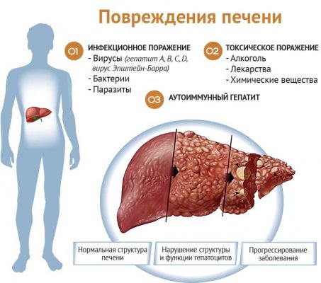 Влияние виагры на печень последствия и рекомендации